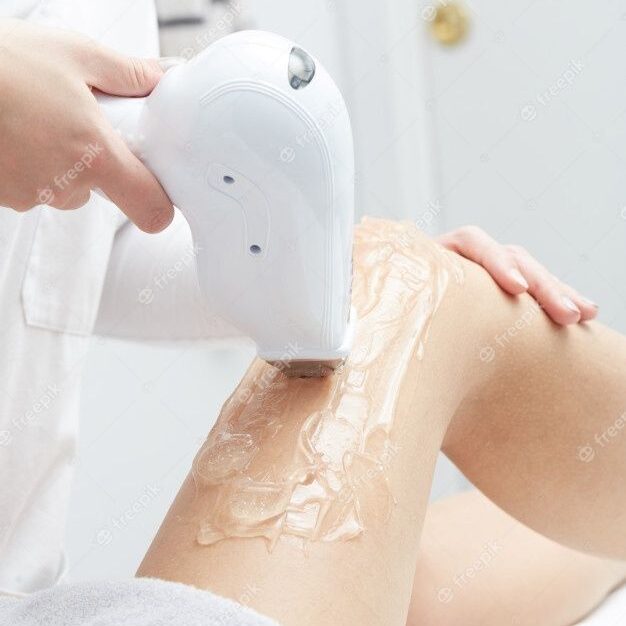 Depilacao A Laser E1769107280308